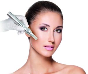microneedling 01 300