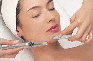 microneedling 02 300